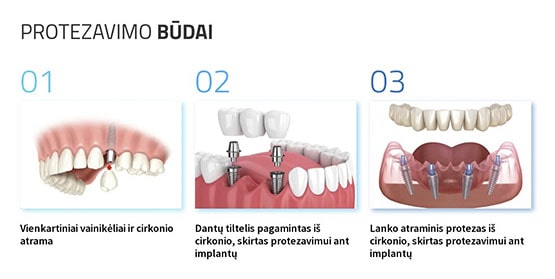 ВЕБ дизайн Vilnius Dental Clinic